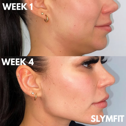 Refine your jawline. Erase your double chin.